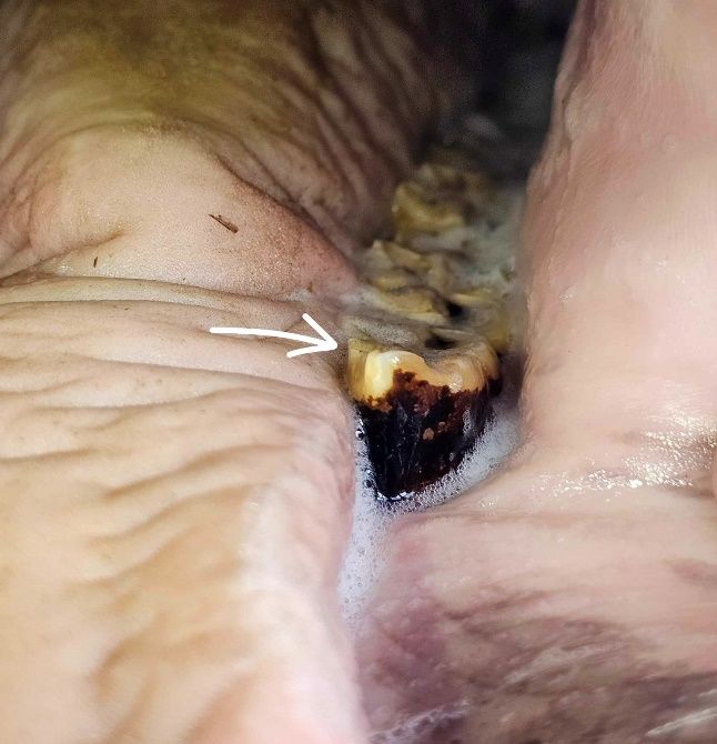 Figure 3. Bottom cheek teeth with sharp enamel points on the inside of the teeth indicated by the white arrow. Credit: Brittany Justesen, UF/IFAS.