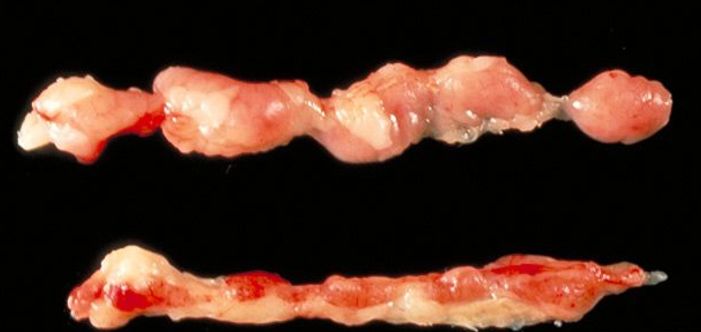 Thymus of 2.5-week-old chicken infected with chicken anemia virus. On top: Normal thymus. On the bottom: The damaged thymus is depleted of lymphocytes.